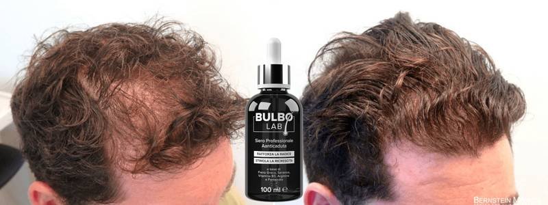 Diradamento maschile