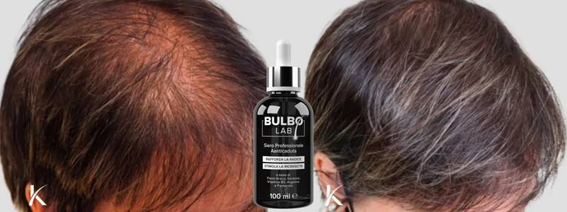 Diradamento femminile centrale