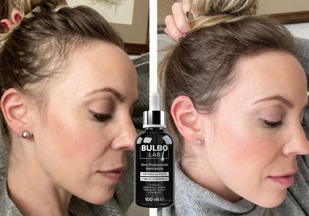 Diradamento femminile