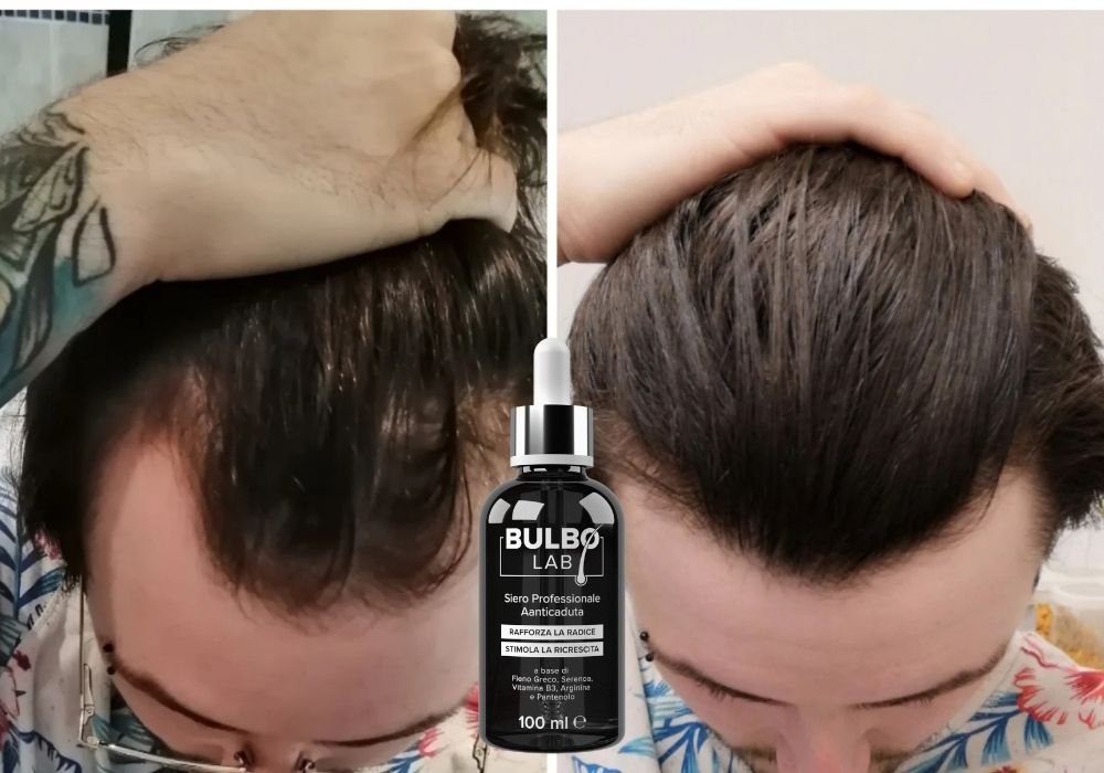 Stempiatura giovanile